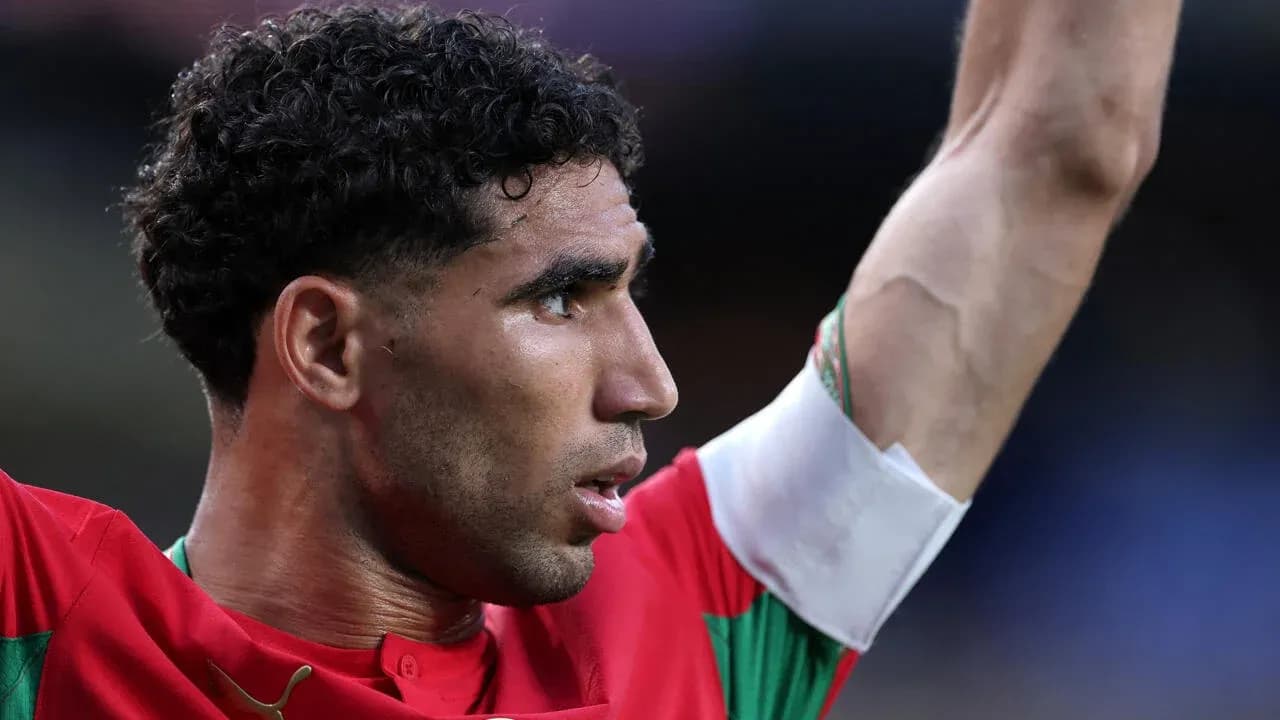 Jugador levantando el brazo durante un partido